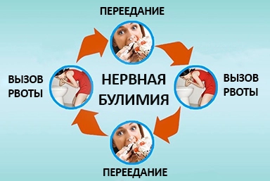 Лечение булимии в Чехове